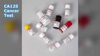 CA125 ELISA-тест для мониторинга рака