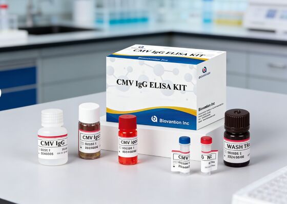 Лабораторный или больничный тест на высокую точность CMV IgG Elisa