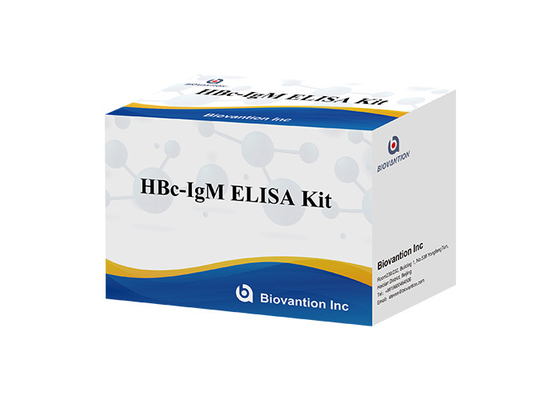 Тест Igm антитела ядра Гепатита B набора теста ISO13485 HBc IgM