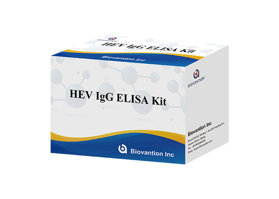 Диагностика набора HEV человеческая Igg Elisa для антитела IgG к вирусу гепатита e