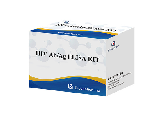 Набор Assay ELISA поколения ВИЧ 4-ого теста Ab Ag ВИЧ ISO13485 60 минут