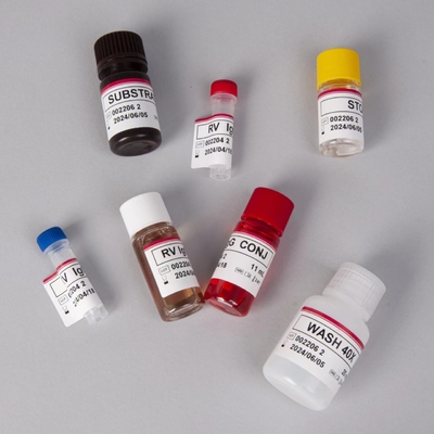 RV-G Elisa Test Kit для диагностики типа образца плазмы