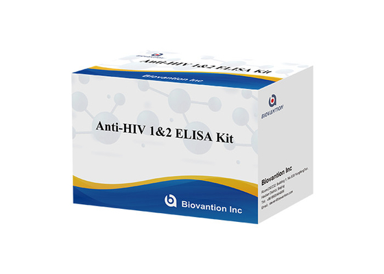 HIV Elisa Test Kit 18-месячный срок годности Elisa Test с высокой чувствительностью и специфичностью