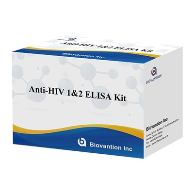 HIV Elisa Test Kit 18-месячный срок годности Elisa Test с высокой чувствительностью и специфичностью
