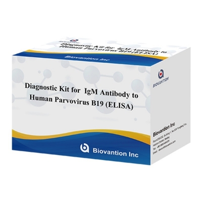 Диагностический комплект для человеческого парвовируса B19 IgM Антитела Elisa Test Kit с 96T