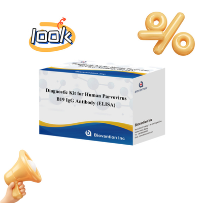 Диагностический комплект для человеческого парвовируса B19 IgM Антитела Elisa Test Kit с 96T