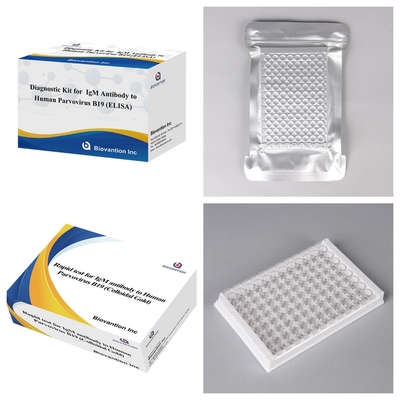 Диагностический комплект для человеческого парвовируса B19 IgM Антитела Elisa Test Kit с 96T