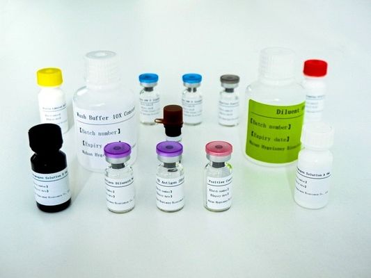 ТБ-ИГРА в сыворотке