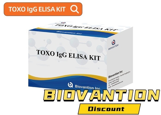 TOXO Ig G чувствительный и специфический тест Elisa для мониторинга заболевания