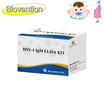Набор для испытаний ELISA с факелом HSV 1 IgM Диагностический реагент IVD с высокой температурой