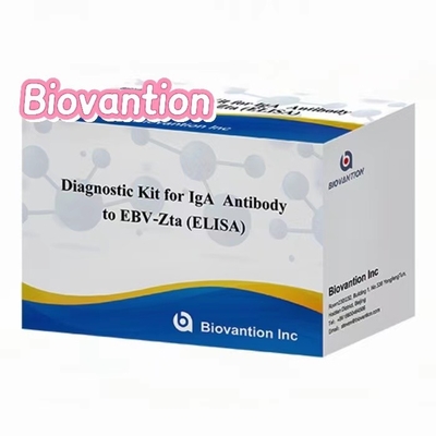 Диагностический комплект для IgA антитела к EBV-Zta ELISA TEST KIT Иммуносорбционный тест
