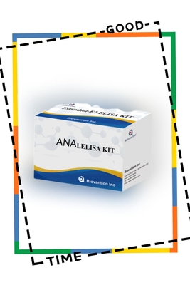 Анти-АНА IgG ELISA тест-кит Анти-ядерные IgG антитела качественное обнаружение