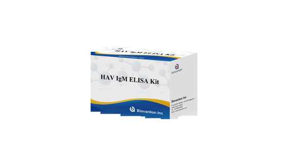 HAV IgM Elisa Test Гепатит А Диагностический комплект Иммуноанализ ферментов In Vitro
