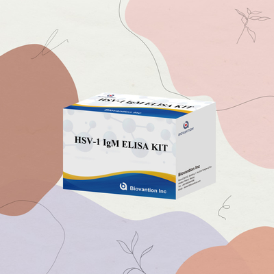 Медицинская диагностика ВИЧ-1 ИГМ Elisa Test Kit с сроком годности 18 месяцев