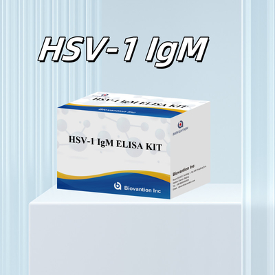 Медицинская диагностика ВИЧ-1 ИГМ Elisa Test Kit с сроком годности 18 месяцев
