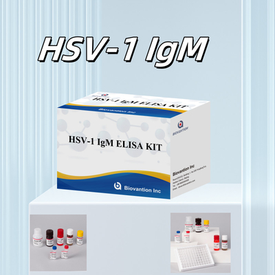 Медицинская диагностика ВИЧ-1 ИГМ Elisa Test Kit с сроком годности 18 месяцев
