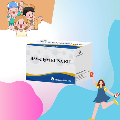 Высокоспецифичный тест Elisa Kit на HSV-2 IgM для быстрых и точных результатов медицинского реагента для использования человеком