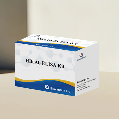 Набор испытаний HBcAb ELISA, набор анализа, набор для обнаружения антитела