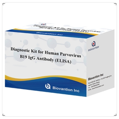 Фабричная прямая продажа Комплект ELISA B19 для парвовируса человека B19 IgM Антитела Elisa Test Kit с 96T