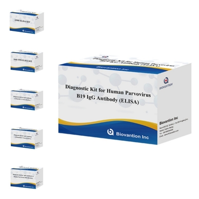 Фабричная прямая продажа Комплект ELISA B19 для парвовируса человека B19 IgM Антитела Elisa Test Kit с 96T