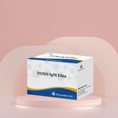 TOXO IgM Elisa Kit для человека Диагностический реагент тест Kit с 96 Kit