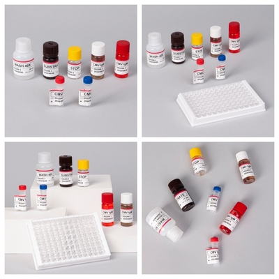 Реагенты иммуноанализа ферментов Elisa Test Kit для обнаружения антител к цитомегаловирусу CMV