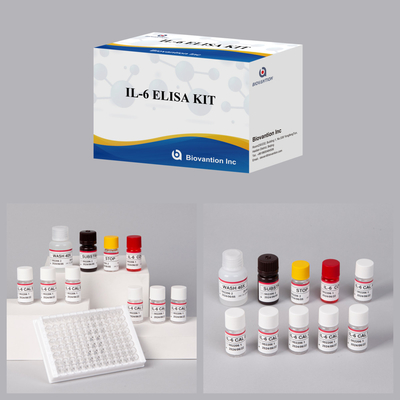 IL6 Интерлейкин-6 для человека Elisa Detect Reagent Elisa Analyzer Исследование