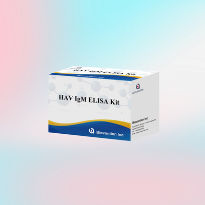 HAV IgM ELISA Kit Высокая чувствительность Гепатит А Вирусная диагностика Надежный точный диагностический тест для клинических лабораторий