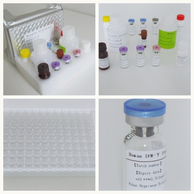 Профессиональный тестовый комплект TB-IGRA Elisa для чувствительного и специфического анализа для человека