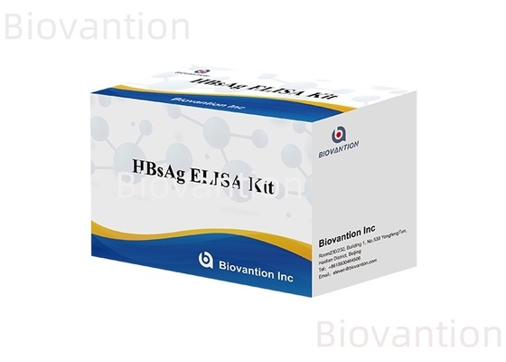 Высокочувствительный специфический HBsAg Elisa Kit для выявления и мониторинга заболеваний