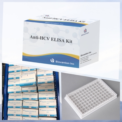 Новый комплект для ИФА-теста на HCV IVD для диагностики человека, больницы, клиники, лаборатории