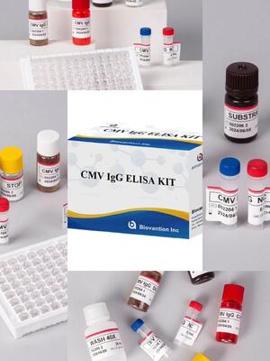 Лабораторный или больничный тест на высокую точность CMV IgG Elisa