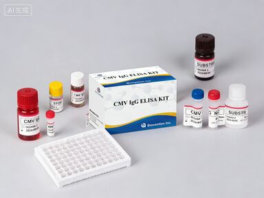 Лабораторный или больничный тест на высокую точность CMV IgG Elisa