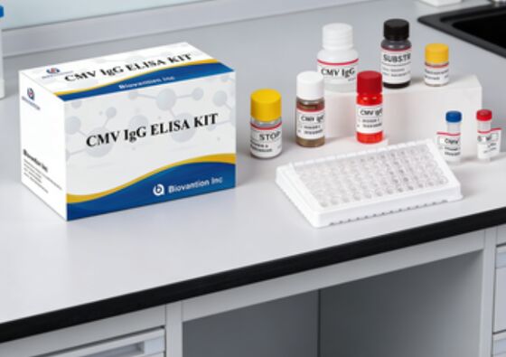 Лабораторный или больничный тест на высокую точность CMV IgG Elisa