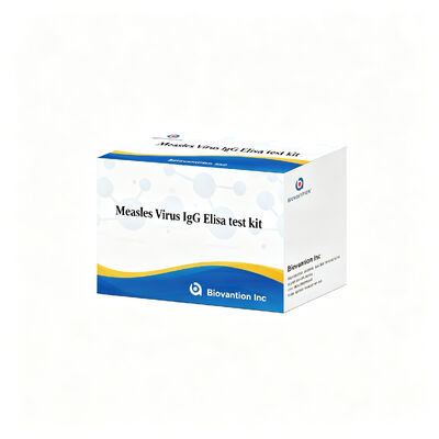Вирус корьи IgG ELISA тест-кит с высокой специфичностью чувствительности