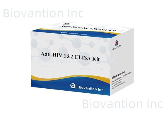 HIV 1/2 ELISA Test Kit 96T Выявление антител к вирусу иммунодефицита человека